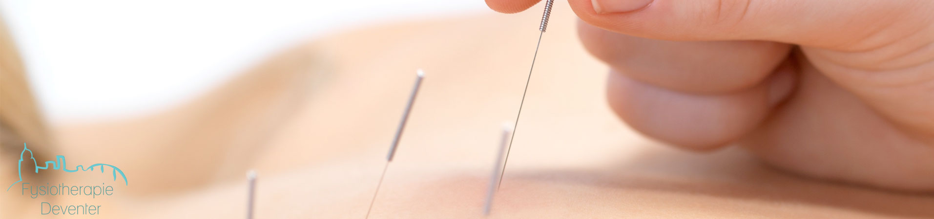 slider dry needling